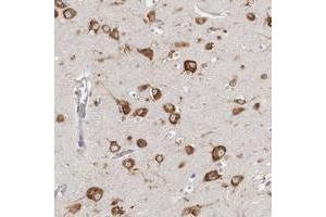 Immunohistochemical staining of human cerebral cortex with FAM167B polyclonal antibody  shows strong cytoplasmic positivity in neuronal cells. (FAM167B Antikörper)