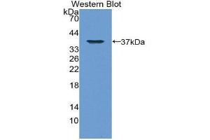 Western Blotting (WB) image for anti-Sequestosome 1 (SQSTM1) (AA 136-400) antibody (ABIN1860638)