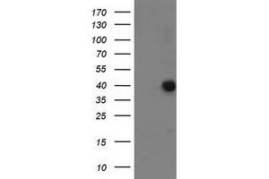 Western Blotting (WB) image for anti-Ankyrin Repeat Domain 53 (ANKRD53) (AA 1-300) antibody (ABIN1490720) (ANKRD53 Antikörper  (AA 1-300))