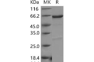 Western Blotting (WB) image for Pyruvate Dehydrogenase Kinase, Isozyme 4 (PDK4) protein (GST tag,His tag) (ABIN7320000) (PDK4 Protein (GST tag,His tag))