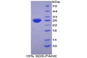 SDS-PAGE analysis of Mouse TrxR1 Protein. (TXNRD1 Protein)
