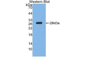 Detection of Recombinant PTPRS, Mouse using Polyclonal Antibody to Protein Tyrosine Phosphatase Receptor Type S (PTPRS) (PTPRS Antikörper  (AA 889-1102))