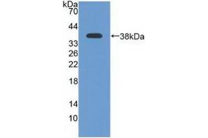 Detection of Recombinant ATR, Human using Polyclonal Antibody to Ataxia Telangiectasia And Rad3 Related Protein (ATR)