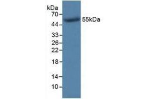 Western Blotting (WB) image for Thymidine Kinase 1, Soluble (TK1) ELISA Kit (ABIN6574311)
