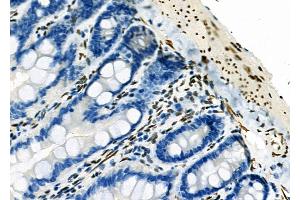 ABIN6263186 and ABIN6273137 at 1/100 staining Rat colorectal tissue by IHC-P. (MECP2 Antikörper  (C-Term))