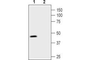 Western blot analysis of mouse kidney membranes:1.