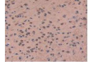 Immunohistochemistry (IHC) image for anti-Chromodomain Helicase DNA Binding Protein 3 (CHD3) (AA 1613-1820) antibody (ABIN7440098)