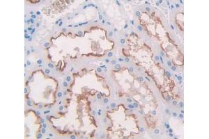 Immunohistochemistry (IHC) image for anti-Nephrosis 1, Congenital, Finnish Type (Nephrin) (NPHS1) (AA 705-1055) antibody (ABIN5013994)