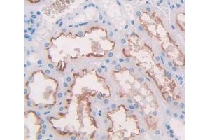 Used in DAB staining on fromalin fixed paraffin- embedded Kidney tissue (Nephrin Antikörper  (AA 705-1055))