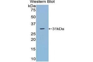 Western Blotting (WB) image for anti-TNFRSF1A-Associated Via Death Domain (TRADD) (AA 21-259) antibody (ABIN3202177) (TRADD Antikörper  (AA 21-259))