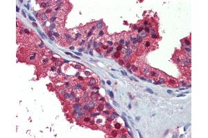 Human, Prostate: Formalin-Fixed Paraffin-Embedded (FFPE) (ACLY Antikörper)