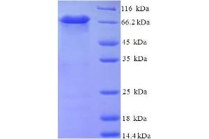 SDS-PAGE (SDS) image for Carboxypeptidase, Vitellogenic-Like (CPVL) (AA 23-476) protein (His-SUMO Tag) (ABIN4976084) (CPVL Protein (AA 23-476) (His-SUMO Tag))