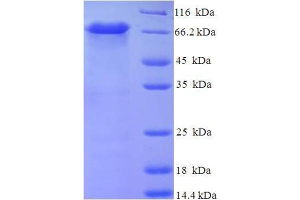 CPVL Protein (AA 23-476) (His-SUMO Tag)