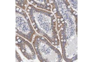 Immunohistochemical staining of human duodenum with ZC3H3 polyclonal antibody  shows moderate cytoplasmic positivity in glandular cells at 1:50-1:200 dilution. (ZC3H3 Antikörper)