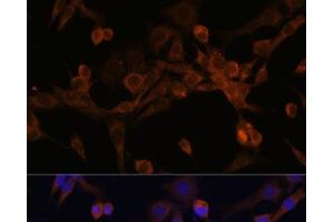 Immunofluorescence (IF) image for anti-Eukaryotic Translation Initiation Factor 2B, Subunit 2 Beta, 39kDa (EIF2B2) antibody (ABIN7262969)