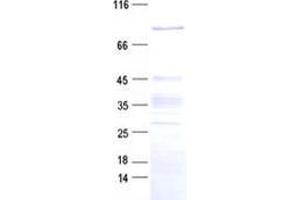 ZNF226 Protein (His tag)