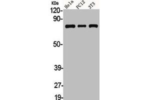 Western Blot analysis of HELA PC12 NIH-3T3 cells using Adducin α/β Polyclonal Antibody (alpha Adducin Antikörper)