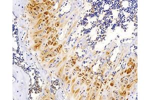 Immunohistochemistry analysis of paraffin-embedded mouse bone using MAGEC1 Polyclonal Antibody at dilution of 1:300. (MAGEC1 Antikörper)