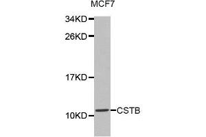 Western Blotting (WB) image for anti-Cystatin B (Stefin B) (CSTB) antibody (ABIN1872053) (CSTB Antikörper)
