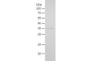 ING2 Protein (AA 1-280) (His tag)