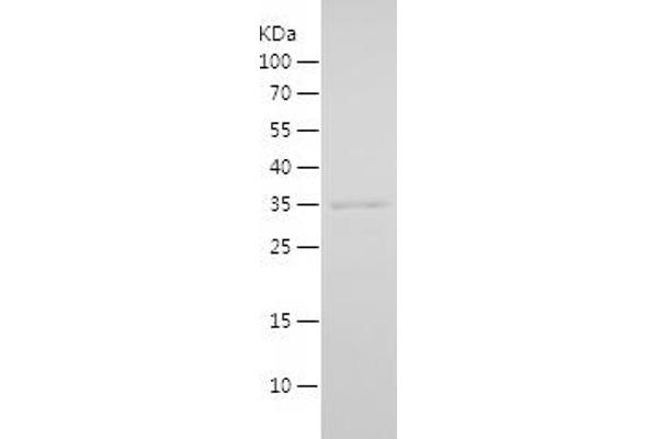 ING2 Protein (AA 1-280) (His tag)