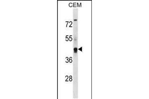 Western blot analysis in CEM cell line lysates (35ug/lane). (Kcng2 Antikörper  (AA 149-177))
