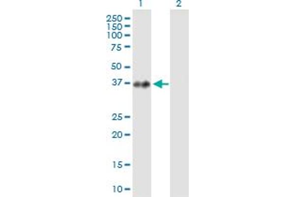 PRPF18 Antikörper  (AA 1-342)