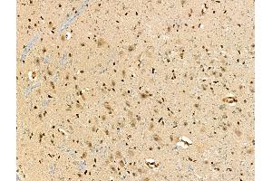 ABIN7093294 and ABIN7097313 at 1/100 staining Rat brain tissue by IHC-P.