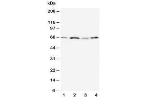Western blot testing of OPN antibody and Lane 1:  MM231