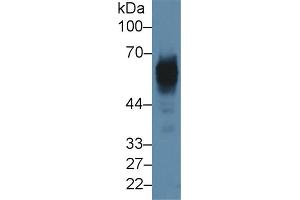 Detection of CK5 in Rat Skin lysate using Polyclonal Antibody to Cytokeratin 5 (CK5) (Cytokeratin 5 Antikörper  (AA 335-473))