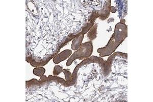 Immunohistochemical staining of human placenta with CPEB4 polyclonal antibody  shows strong membranous and cytoplasmic positivity in trophoblastic cells at 1:200-1:500 dilution. (CPEB4 Antikörper)