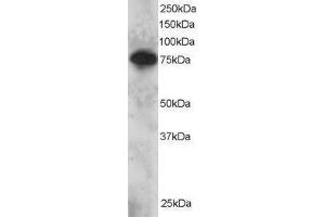 Western Blotting (WB) image for SET Domain and Mariner Transposase Fusion Gene (SETMAR) peptide (ABIN370433) (SET Domain and Mariner Transposase Fusion Gene (SETMAR) Peptid)