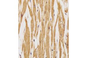 (ABIN389572 and ABIN2839598) staining HER4 in human heart tissue sections by Immunohistochemistry (IHC-P - paraformaldehyde-fixed, paraffin-embedded sections). (ERBB4 Antikörper  (pTyr1162))