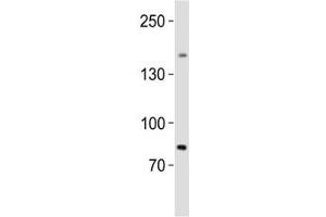Western blot analysis of lysate from human testis tissue lysate using SALL4 antibody diluted at 1:1000.