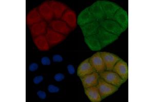 ABIN6259081 and ABIN6273900 staining Hela cells(30 min of UV treatment) by IF/ICC.