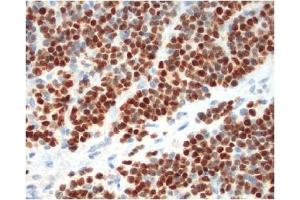 Immunohistochemistry (IHC) image for anti-Myogenin (Myogenic Factor 4) (MYOG) antibody (ABIN953581) (Myogenin Antikörper)