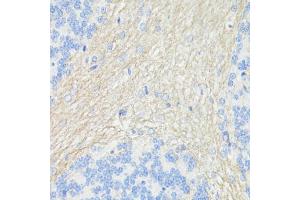 Immunohistochemistry of paraffin-embedded rat brain using CD90/Thy1 antibody (ABIN7266228) at dilution of 1:100 (40x lens). (CD90 Antikörper  (AA 31-81))