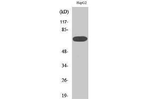 Western Blotting (WB) image for anti-Mitogen-Activated Protein Kinase Kinase Kinase 3 (MAP3K3) (Internal Region) antibody (ABIN3180171) (MAP3K3 Antikörper  (Internal Region))