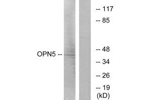 Western blot analysis of extracts from Jurkat cells, using OPN5 antibody.