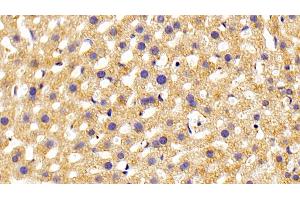 Detection of PLCe1 in Mouse Liver Tissue using Polyclonal Antibody to Phospholipase C Epsilon 1 (PLCe1) (PLCE1 Antikörper  (AA 1-250))