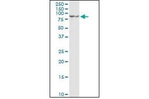 Western Blotting (WB) image for anti-Proprotein Convertase Subtilisin/kexin Type 1 (PCSK1) (AA 652-754) antibody (ABIN781869) (PCSK1 Antikörper  (AA 652-754))