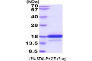 SDS-PAGE (SDS) image for Neurotensin (NTS) (AA 24-148) protein (His tag) (ABIN5854756)