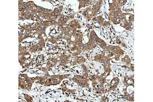IHC analysis of CBR1 using anti-CBR1 antibody (ABIN7600015). (CBR1 Antikörper  (AA 14-262))