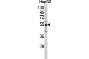 Western Blotting (WB) image for anti-Cytochrome P450, Family 2, Subfamily J, Polypeptide 2 (CYP2J2) antibody (ABIN3003218) (CYP2J2 Antikörper)
