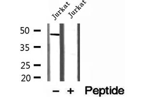 Western blot analysis of extracts of Jurkat cells, using MAGT1 antibody. (MAGT1 Antikörper  (Internal Region))