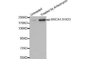 Western blot analysis of extracts from HT29 cells, using Phospho-BRCA1-S1423 antibody (BRCA1 Antikörper  (pSer1423))