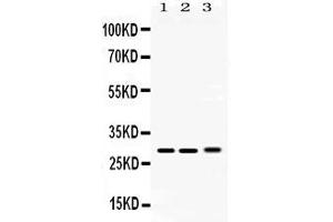 Western blot analysis of PSMA3 expression in rat testis extract ( Lane 1), mouse lung extract ( Lane 2) and 293T whole cell lysates ( Lane 3). (PSMA3 Antikörper  (Middle Region))