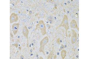 Immunohistochemistry of paraffin-embedded Mouse brain using EPHA2 Polyclonal Antibody at dilution of 1:100 (40x lens). (EPH Receptor A2 Antikörper)