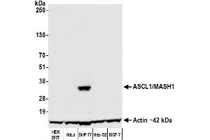 Western Blotting (WB) image for anti-Achaete-Scute Complex Homolog 1 (Drosophila) (ASCL1) (AA 186-236) antibody (ABIN7455113) (Rekombinanter ASCL1 Antikörper  (AA 186-236))