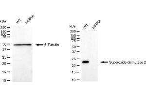 Western blotting analysis using Superoxide dismutase 2 antibody (ABIN7800463).